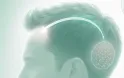 FUE Hair Transplant