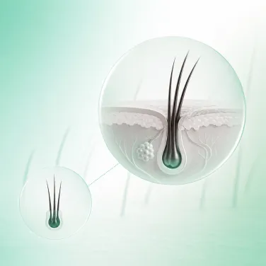 A follicular unit producing several hairs
